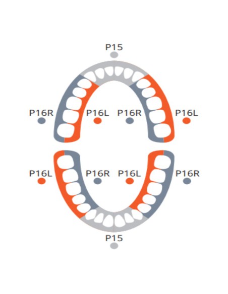 Insertos para Periodoncia Anátomicos para Ultrasonidos Mectron