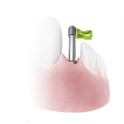 SmartPegs Osstell Pack 10 unidades 2