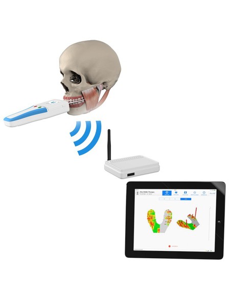 Sensores de presión Digital para Occlusense