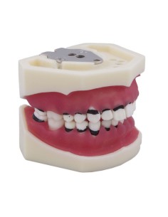 Tipodonto de Periodoncia sin Articulador