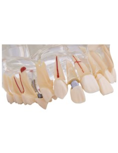 Macromodelo con Patología Completa 2