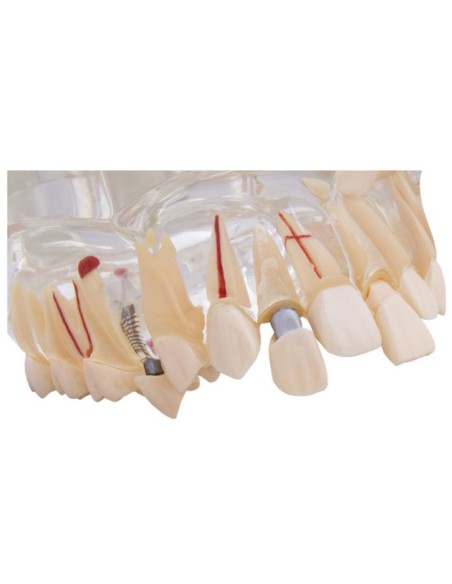 Macromodelo con Patología Completa