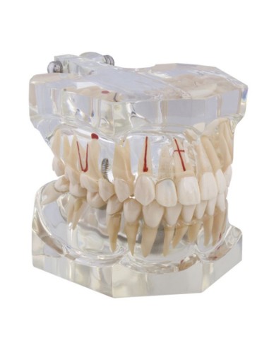 Macromodelo con Patología Completa