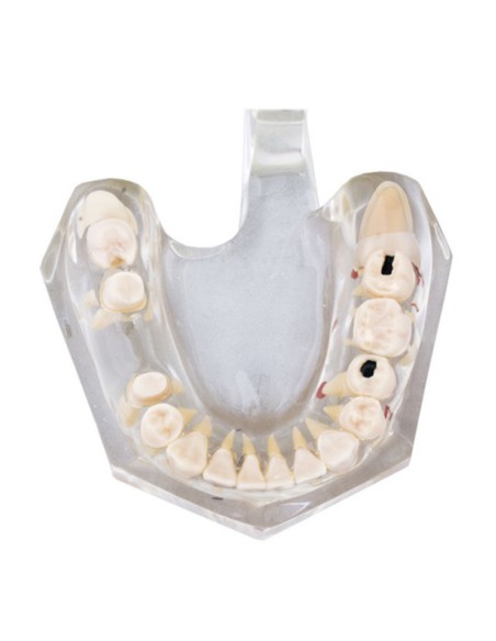 Macromodelo con Patología Completa