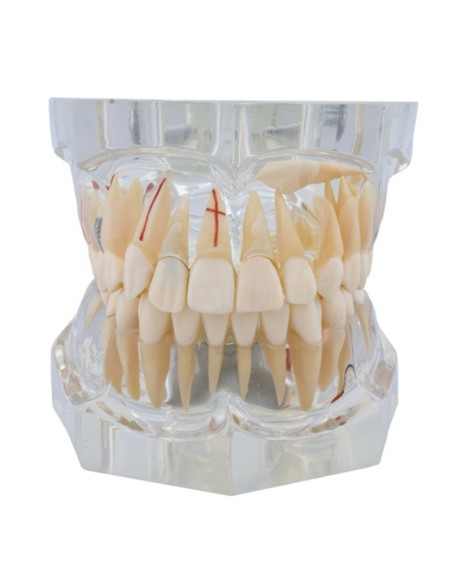 Macromodelo con Patología Completa