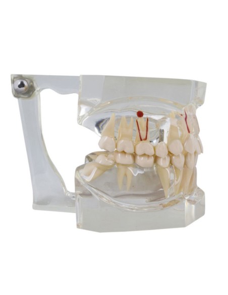 Macromodelo con Patología Completa