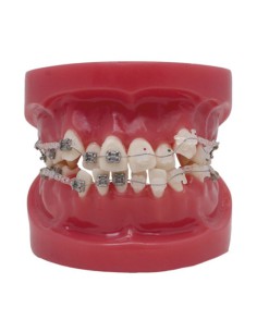 Modelo To-Bracket Metal y Zafiro