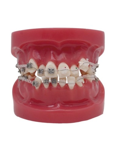 Modelo To-Bracket Metal y Zafiro