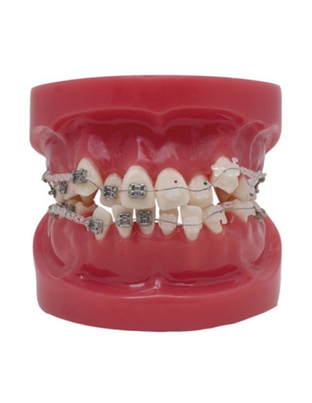 Modelo To-Bracket Metal y Zafiro