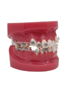 Modelo To-Bracket Metal y Zafiro 2