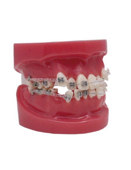 Modelo To-Bracket Metal y Zafiro