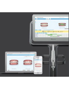 Itero Escaner Intraoral 2