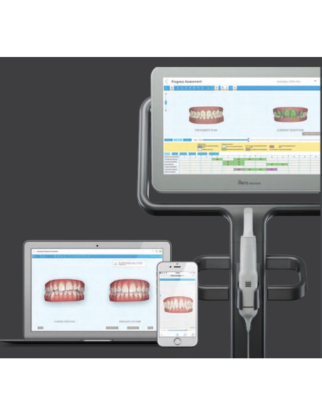 Itero Escaner Intraoral