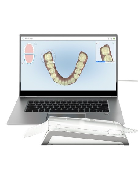 Itero Escaner Intraoral
