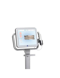 Itero Escaner Intraoral