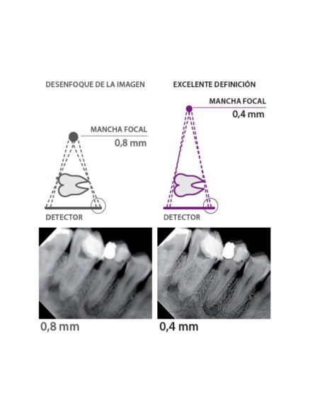 Unidad de Rayos X Intraoral RXDC de Alta Frecuencia