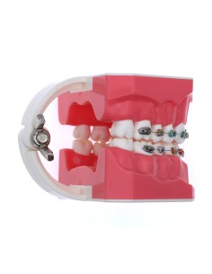 Tipodonto Adulto con Brackets Metálicos 32 dientes 2