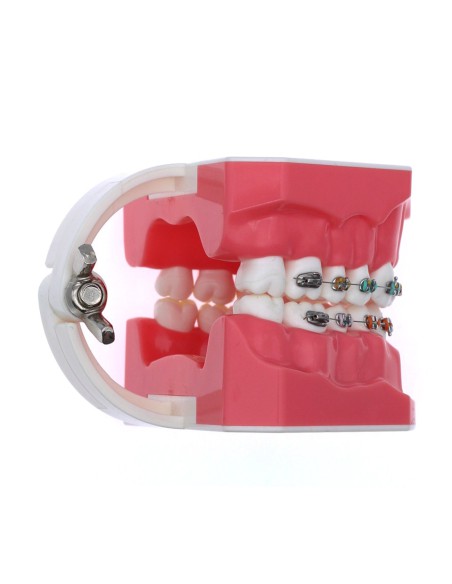 Tipodonto Adulto con Brackets Metálicos 32 dientes