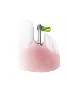 SmartPegs Osstell Pack 20 unidades 2