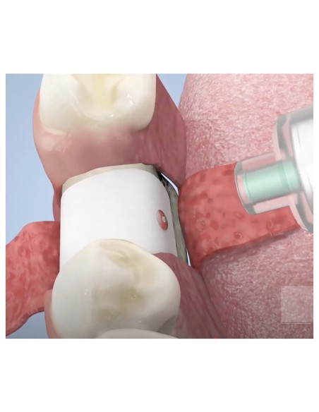 Fijador de Chinchetas Smartact Evo Cable 150 mm META