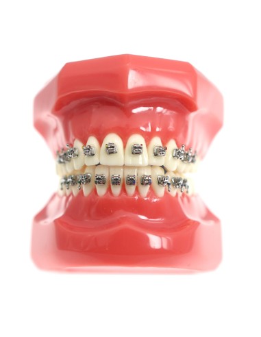 Tipondonto Modelo con Brackets Interactivos Metálicos de Estudio SlimDent