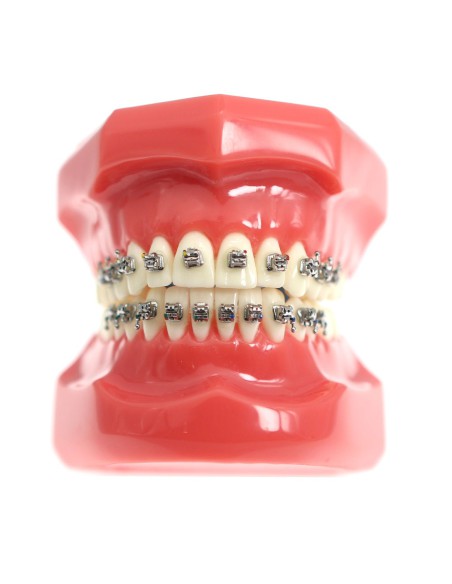 Tipondonto Modelo con Brackets Interactivos Metálicos de Estudio SlimDent