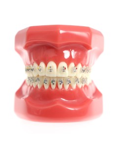 Tipondonto Modelo con Brackets Interactivos Cerámicos de Estudio SlimDent