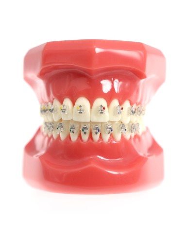 Tipondonto Modelo con Brackets Interactivos Cerámicos de Estudio SlimDent
