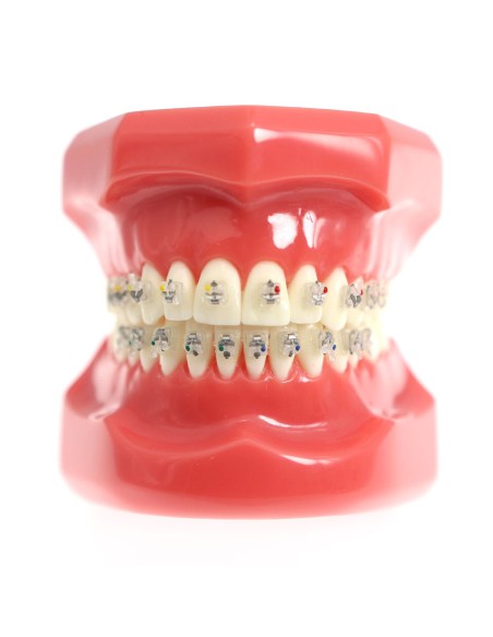 Tipondonto Modelo con Brackets Interactivos Cerámicos de Estudio SlimDent