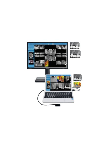 Sensor Intraoral de Rayos X Digital i-Sensor 70 Tamaño 2, Grande Qualinx