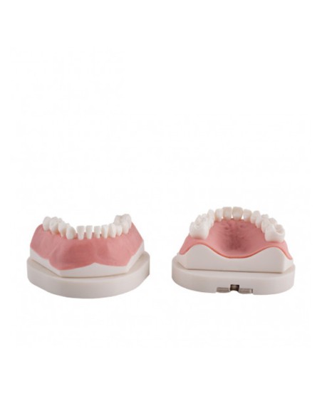 Tipodonto Infantil Clónico Frasaco AK6 con Placa Base  de Bader