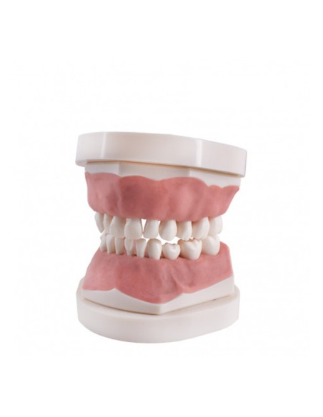 Tipodonto Infantil Clónico Frasaco AK6 con Placa Base  de Bader