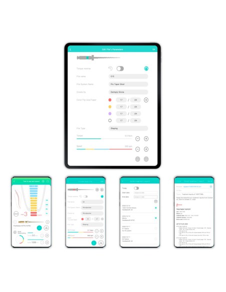 Motor Endo Smart A Inalámbrico, Recíproco, CA Super Mini 6:1 Localizador de Ápices Lava Orange de Woodpecker