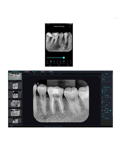 Digitalizador Placas de Fósforo VistaScan Mini Easy Radiología Dental Dürr