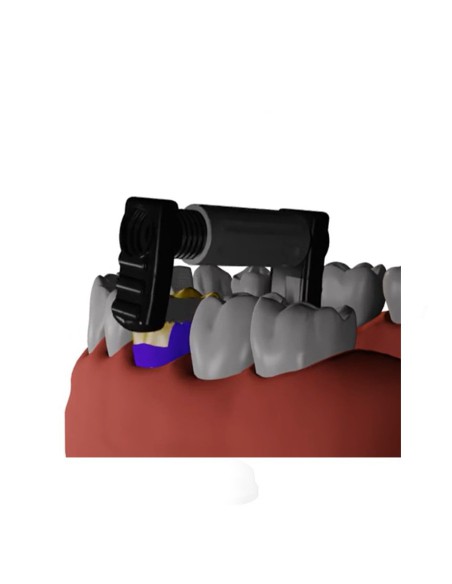 Fitstrio Kit Universal Contorneado y Acabado Interproximal Garrison