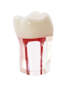 Molar Conductos Radiculares Modelo Prácticas Endodoncia Bader