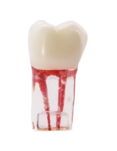Molar Conductos Radiculares Modelo Prácticas Endodoncia Bader 2