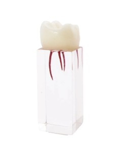 Molar Endodoncia con Conductos Prácticas Estudiantes Bader 2