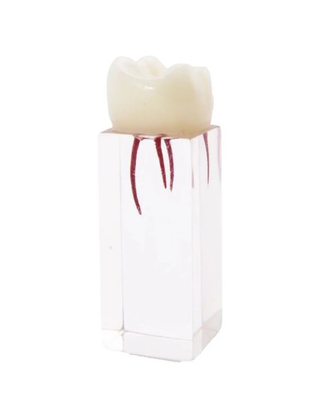 Molar Endodoncia con Conductos Prácticas Estudiantes Bader