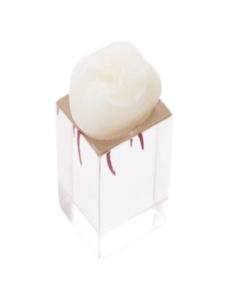 Molar Endodoncia con Conductos Prácticas Estudiantes Bader