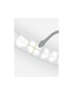 Inserto B7 Cirugía Ósea para Piezomed W&H 2