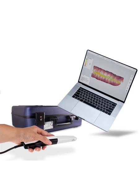 Escáner Intraoral Bader