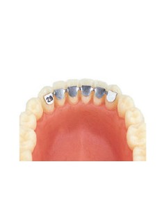 Kit Retenedores Canino Canino Inferior Cementado Directo 10 uds Leone