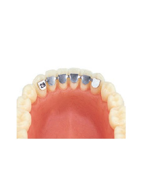 Kit Retenedores Canino Canino Inferior Cementado Directo 10 uds Leone