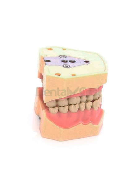 Tipodonto Clónico Frasaco AG-3 de 32 Dientes Adulto