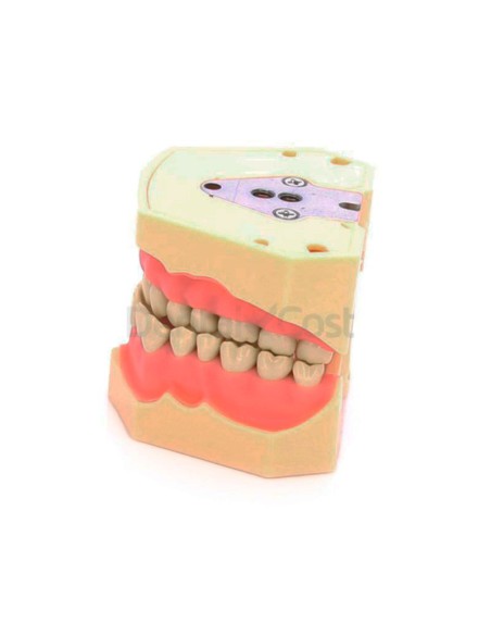 Tipodonto Clónico Frasaco AG-3 de 32 Dientes Adulto