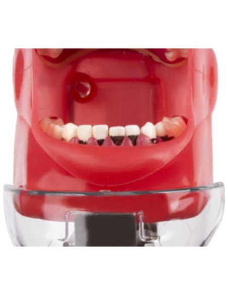 Cálculo Dental para Tipodonto Periodontal Recarga 30 ml Bader