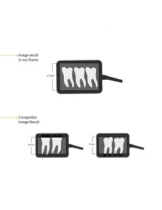 Sensor de Rayos X Digital HDR 600A Área 36 x 27 mm Bader Dental 2