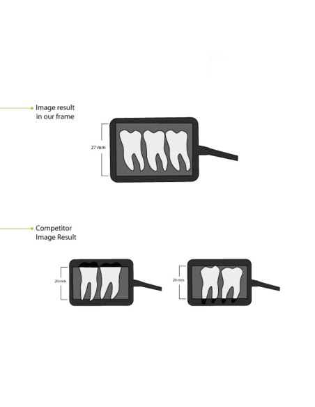 Sensor de Rayos X Digital HDR 600A Área 36 x 27 mm Bader Dental