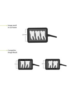 Sensor de Rayos X Digital HDR 500A Área  30 x 22,5 mm Bader Dental 2